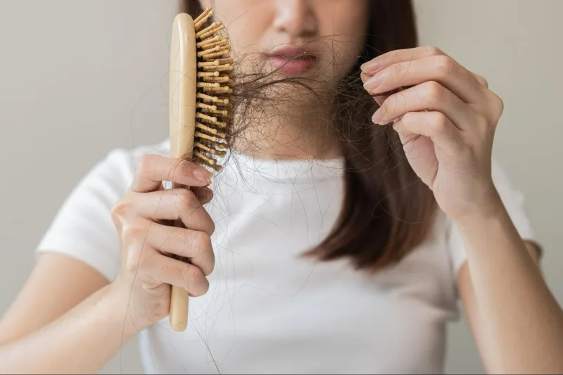 Rụng tóc có thể liên quan đến stress, dinh dưỡng, nội tiết, di truyền hoặc bệnh lý da đầu