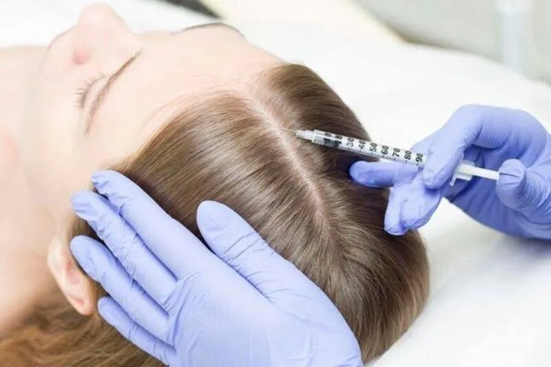 Một số dạng rụng tóc cần thuốc kê đơn, điều trị nhiễm nấm, tự miễn hoặc can thiệp chuyên sâu