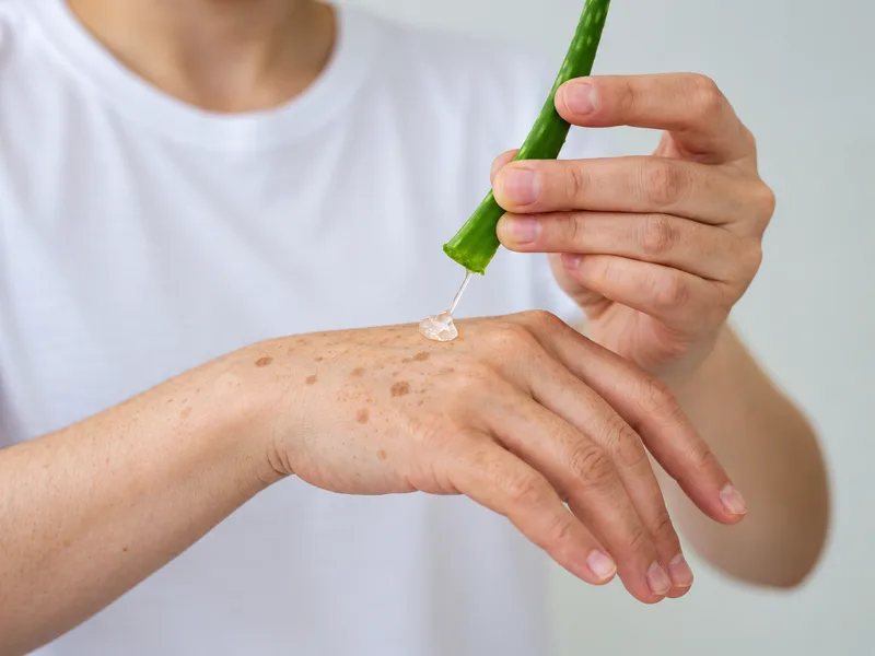 Gel nha đam hỗ trợ dưỡng ẩm, làm dịu da tay có đốm nâu.